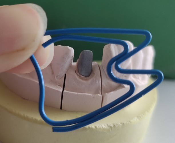 ISO13485 Pivot Core Dental Post And Core For Fracture Tooth