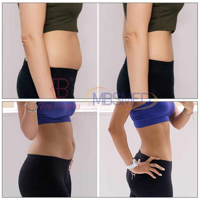 Cet Ret Monopolar Rf Skin Tightening Machine With Touch Screen