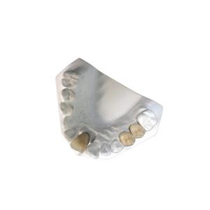 China High Stability Ceramic Dental PFM Crown Natural Tooth Stain Resistant wholesale