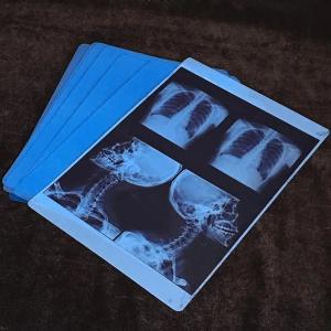 China Medical Based Dry Imaging Xray Film For Making X-ray Film wholesale