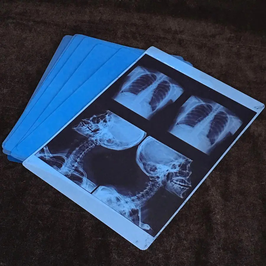Excellent UV Resistance Inkjet X Ray Film for High Temperature Applications