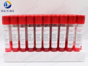 China 10ml Blood Specimen Tubes Inactivated Virus Preservation wholesale