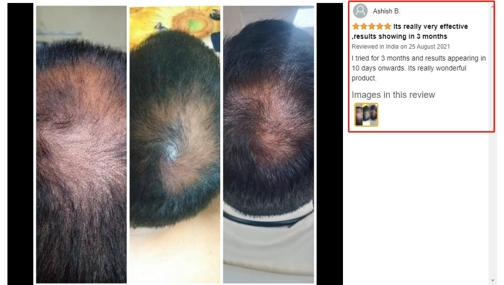Customization Hair Growth Treatment Serum for Black Women Private Label