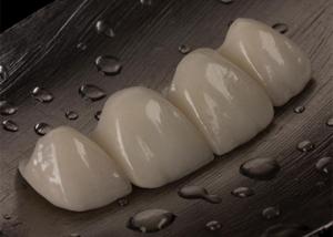 China Customizable Ceramic Crown Bridge For Missing Tooth Comfortable Perfect Fit wholesale