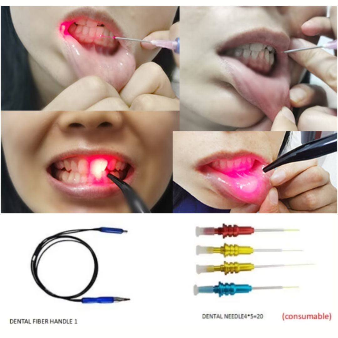 Dental Soft Tissue Laser 980nm Teeth Physiotherapy Pain Removing Teeth Whitening Laser Dental Clinic Therapy