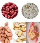 304 Stainless Steel Multifunction Vegetable Cutting Machine Automatic Cashew Nut