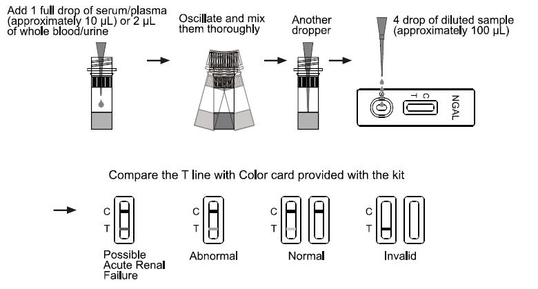 150-400ng/Ml Neutrophil Gelatinase Associated Lipocalin Test NGAL One Step Rapid Test