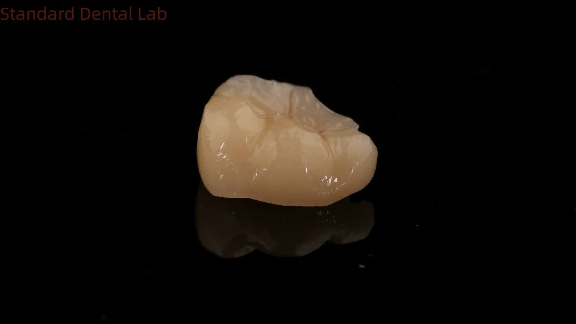 Strength Emax Ceramic Crown Dental Onlay with Excellent Stain Resistance China Dental Lab