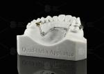 Children And Adolescents Quad Helix Appliance Orthodontics Stainless Steel