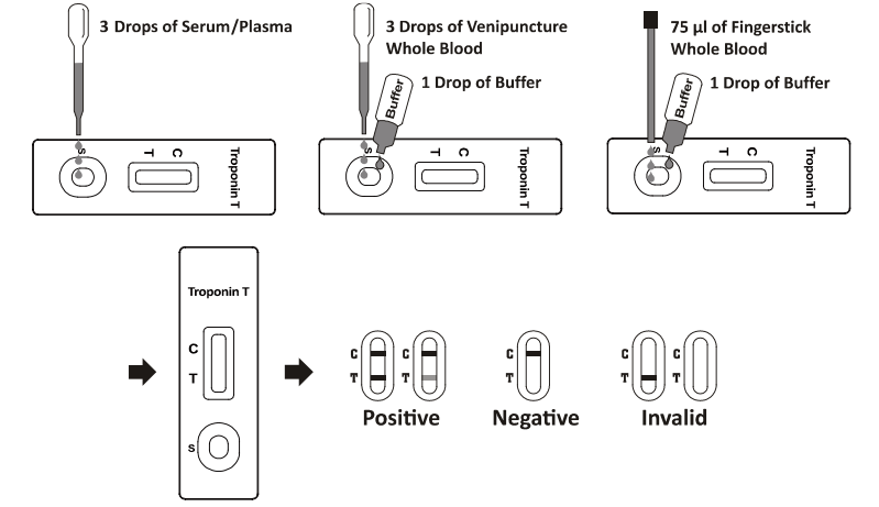 CTnT Cardiac Troponin T Rapid Test Chromatographic Immunoassay WB S P