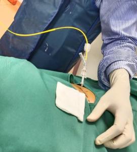 China 980nm PLDD Minimally Invasive Laser wholesale