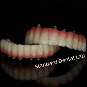 China Implant Screw Cement Retained Dental Restorations from Standard Dental Lab wholesale