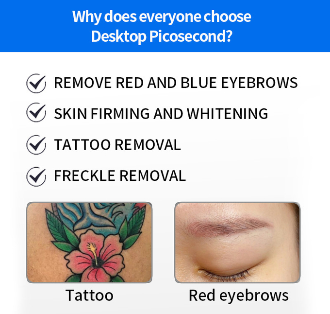 Pigment Removal Q-Switched ND YAG Laser Tattoo Removal ф7 And ф8 Yag Bars