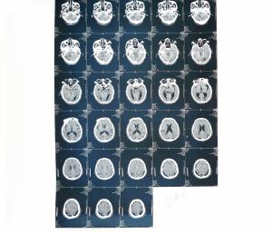 China Degradable White Base PET Material X ray Paper Medical Film wholesale