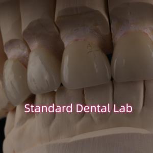 China Professional Dental Lab Zirconia Crown For Fixed Restoration wholesale