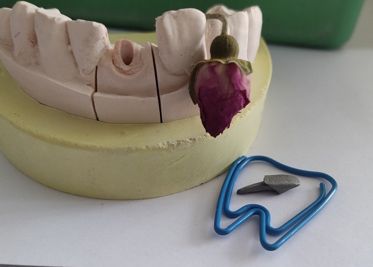 ISO13485 Pivot Core Dental Post And Core For Fracture Tooth