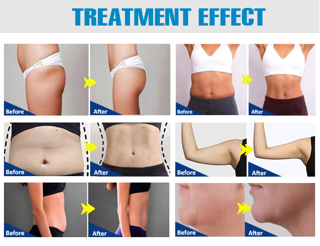 Muscle Stimulator Weight Loss Slim Beauty Machine Body Muscle Sculpt