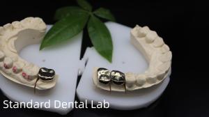 China Professional ISO and FDA Approved Yellow Gold Crown for Dental Lab Shipping UPS Or Fedex Production Time 2 Days wholesale