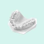 High Temp Photosensitive Resin Orthodontic Models Quick Cure Resin