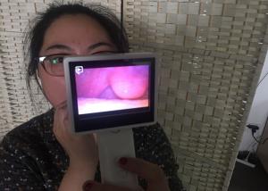 China ENT Endoscopy Rhinoscopy Medical Video Camera Digital Otoscope For Nose Checking With LCD Screen wholesale
