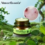 Gentle Skin Care Acne Treatment Cream 30g For Acne Prone Sensitive Skin