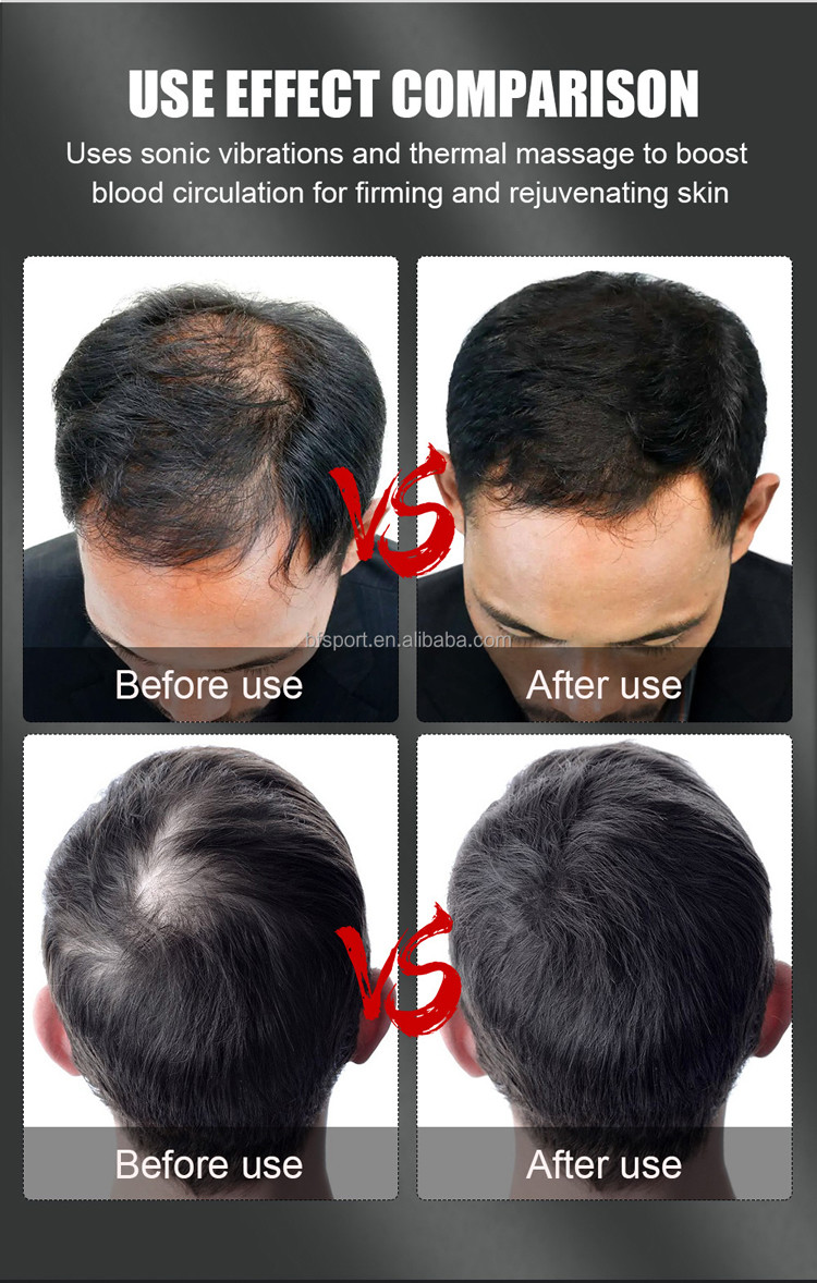 660nm 850nm Red Laser Helmet , Portable Red Light Hat Hair Growth