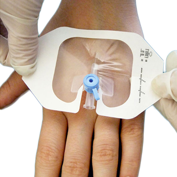 OEM Transparent Wound Dressing IV Cannula Dressing for Wound Care