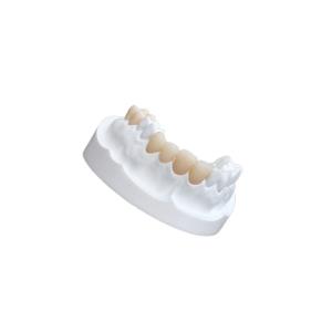 China IPS E Max Ceramic Dental Crown Comfortable Porcelain Composite Veneers wholesale