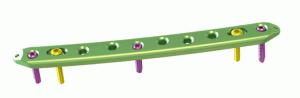 China CE Lateral Hook Proximal Femoral Locking Plate wholesale