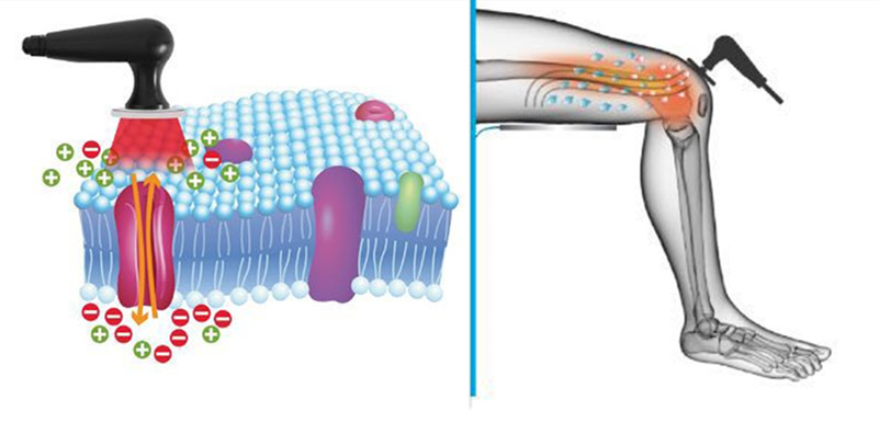 Physiotherapy Smart Tecar Therapy Machine For Spine Pain