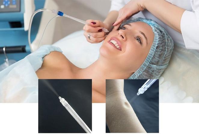 Needle Free Injector Myjet Oxygen jetPeeling Skin For Under Eye Bags Fine Lines And Wrinkles Treatment