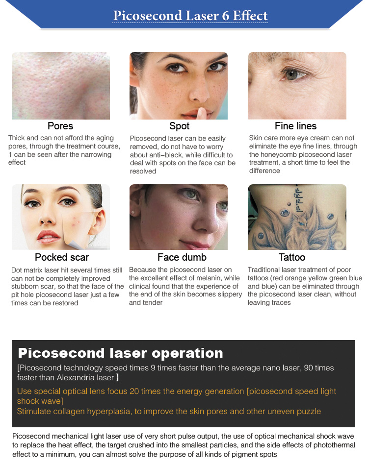 2000W Picosecond Laser Tattoo Removal Machine Q Switched Nd Yag Skin Rejuvenation