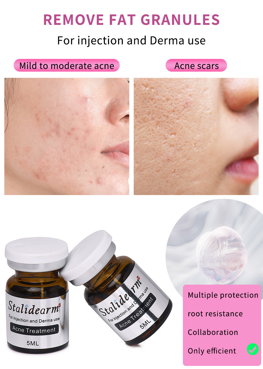 Stalidearm Facial Care Face Moisturizing Skin Firming Meso Serum Anti Wrinkles Collagen Dermal Filler 5ml