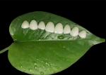 Minimal Preparation Porcelain EMAX Veneer For Cosmetic Dental Treatment
