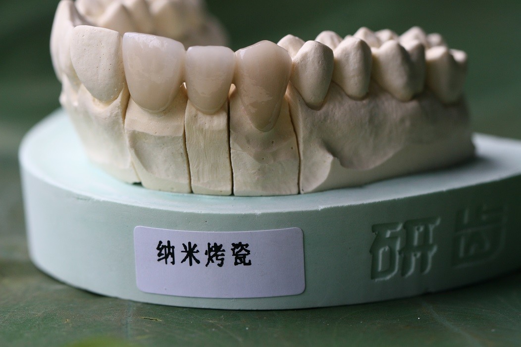 Dental Lab Product CAD CAM PFM Crown porcelain fused to metal