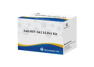 China Human Anti HIV 1&amp;2 Elisa Test Kit For Human Immunodeficiency Virus wholesale