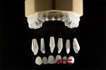 Dental Porcelain Feldspathic Veneers For Teeth Custom Shaped