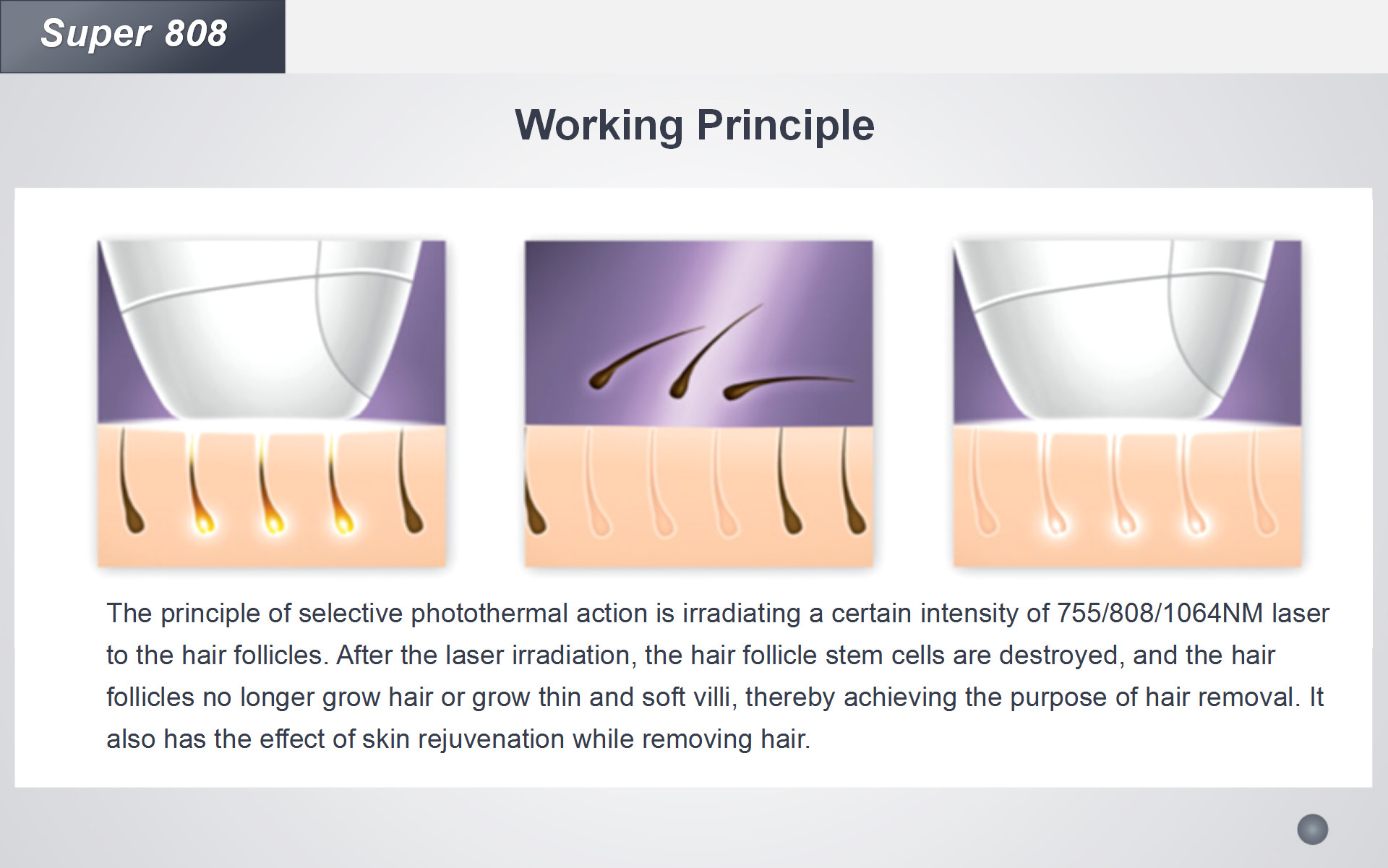 No Pain 808nm Diode Laser Hair Removal Beauty Machine Permanent