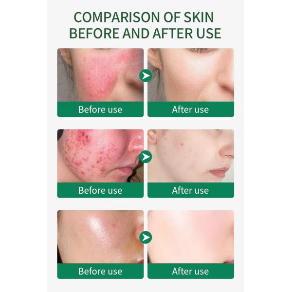 Oem Repairing Glycerin Hydrating Serum face Skincare Whitening Pore Shrinking