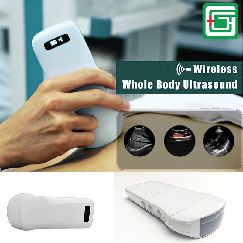 DICOM Medical Hospital Equipments 128 Element Portable Wifi Wireless Ultrasound Scanner