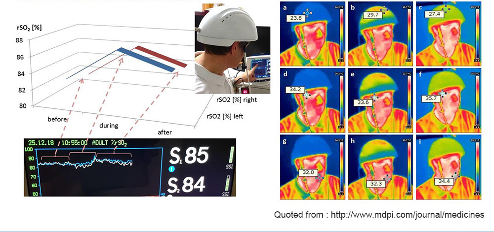 810nm Near Infrared Photobiomodulation Belt Brain Therapy Wrap Improve Memory