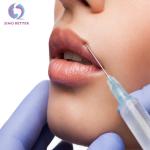 Fashionable Hyaluronic Acid Fillers Face Wrinkles Correction Medical Grade