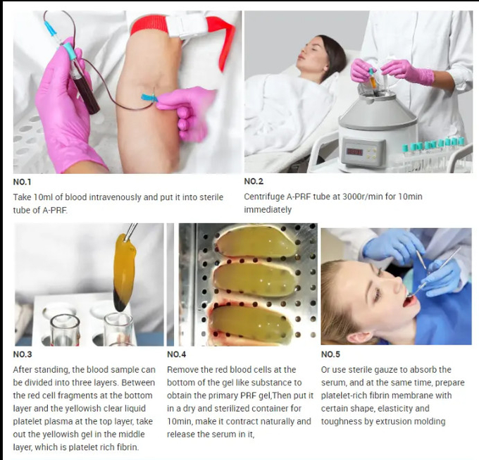 10ml 13ml PRF Centrifuge Tube Recommended Storage Temperature 4-25C Plastic Tube for Medical Lab
