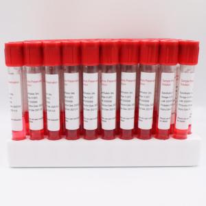 China 5ml Special Thread Sample Collection Tube Ethylene Oxide wholesale
