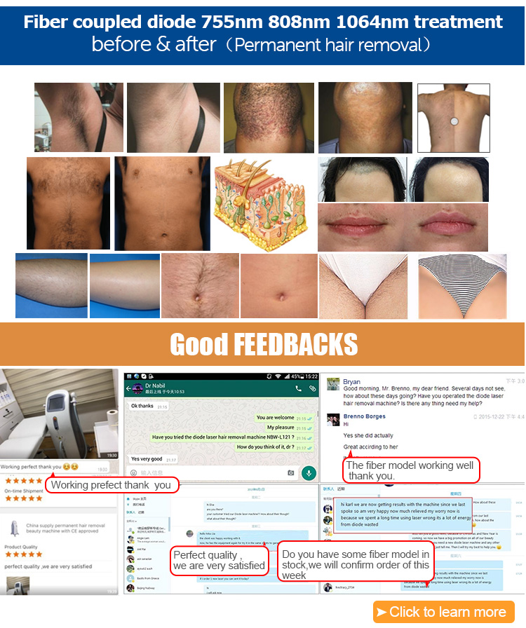 3 In 1 OPT + IPL+ Rf+ Nd YAG Permanent laser Tattoo Removal Skin Rejuvenation beauty machine Laser Hair Removal Machine