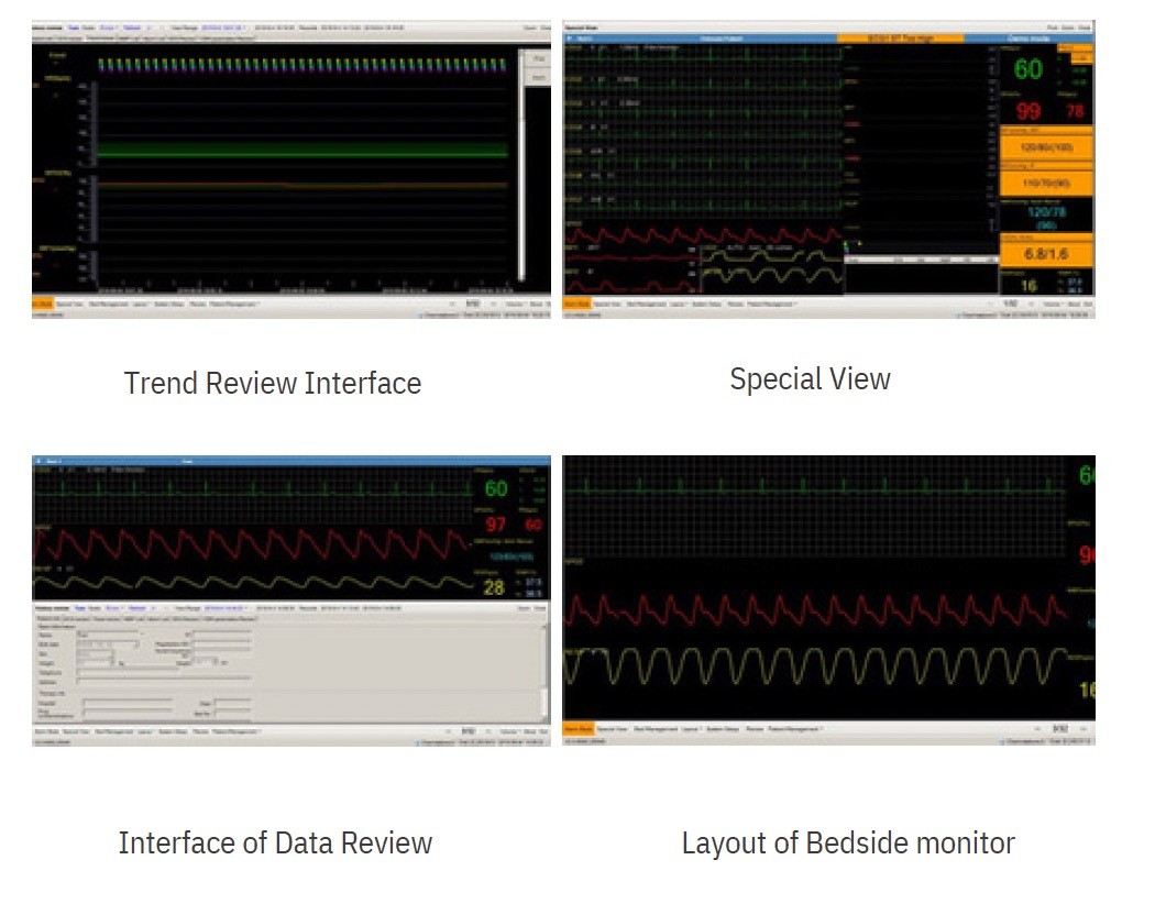 Center Monitoring System for Portable Multi-parameter Patient Monitor, cardiac monitor
