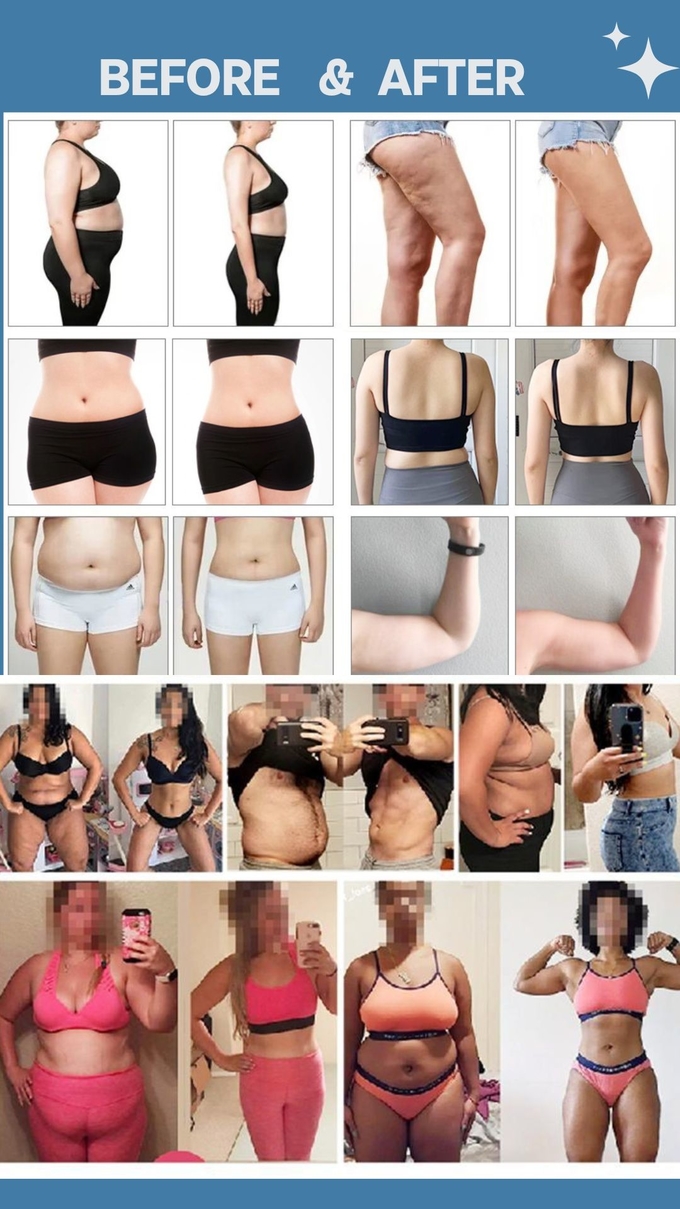 Fat Tighten Skin 10D Diode Lamp Cold Laser Therapy Device Laser Machine For Losing Weight