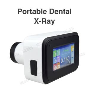 China Portable Dental X-Ray wholesale