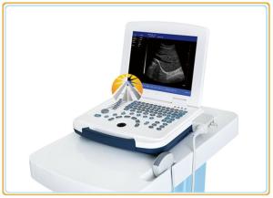 China High Definition Digital Ultrasound Machine , Advanced Real Time Ultrasound Machine wholesale