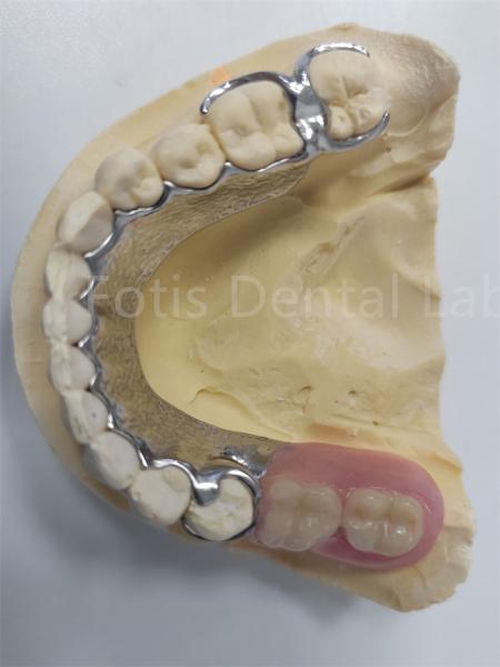 Replace Missing Teeth Removable Partial Denture Dental Prosthesis Flexible